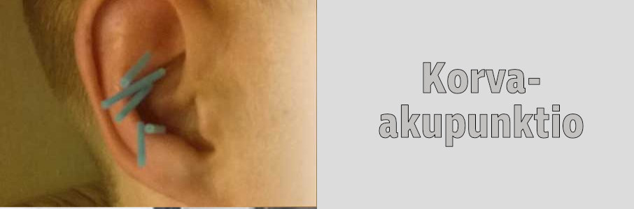 Korva-akupunktio
